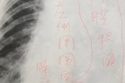 放射科宣传视频
:学医的你，对放射科了解多少？