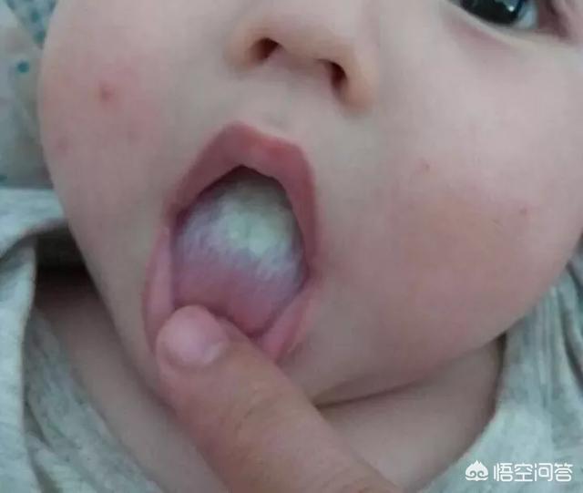 短黄视频
:宝宝积食有什么具体表现？什么情况下妈妈不该再喂食了？  第3张